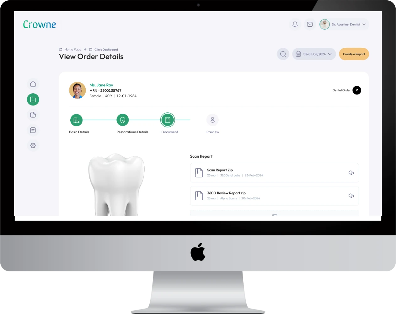 Crowne dental CRM order details screen shown on a desktop monitor